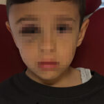 Sallanıp yere fırlatılan 7 yaşındaki Güney’in babası: Yaşı küçük şüpheliler yaptırımla karşılaşmalı 4 sallanip yere firlatilan 7 yasindaki guneyin babasi yasi kucuk supheliler yaptirimla karsilasmali db8c4c6fb089