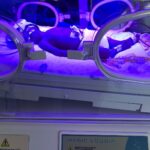 17 gunlukken kuvozden dusen suleyman bebege serebral palsi teshisi konuldu ailesi sikayetci oldu faf8243784a1