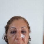 kedi besleme kavgasinda komsusunun burnunu kirdi o anlar kamerada 621c8066b5e3
