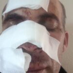 Baskil'de Eniştesine Çarpan Şahıs Tutuklandı 7 enistesine aracla carpip kacti o anlar kamerada video eklendi 686fd9b14d32