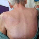 huzurevinde olumde sanik doktor hakkinda yakalama karari e5403e562192