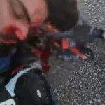 Biga'da Motosiklet Kazasında Ağır Yaralanan Genç, 23 Gün Sonra Yaşam Mücadelesini Kaybetti 1 motosiklet kazasinda yaralanan ahmet can 23 gun sonra hayatini kaybetti 83d6013636e8