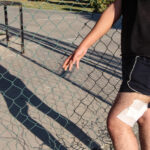 Adana'da Bıçaklı Saldırıya Uğrayan B.K., Saldırganları Tanımadığını Açıkladı 4 parkta tartistiklari 3 lise ogrencisini dovup bicakladilar olay kamerada 2 6030e64c7164