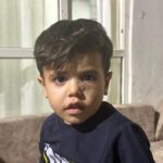 yorgun mermi 4 yasindaki cocugun gozunun altina isabet etti fcb851a89c54