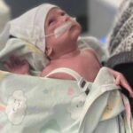 600 gram dogan ve 98 gun tedavi goren asil bebek 2 yasinda a9ab0e03b7cd