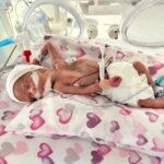 600 gram dogan ve 98 gun tedavi goren asil bebek 2 yasinda ae1af8ed2359