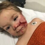 ankarada pitbull saldirisina ugrayan 15 ve 5 yasindaki kardesler yaralandi 2 yeniden 13790413fead