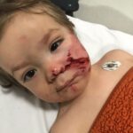 Ankara'da Pitbull Saldırısında İki Çocuk Yaralandı 4 ankarada pitbull saldirisina ugrayan 15 ve 5 yasindaki kardesler yaralandi 6e48766f5dd9