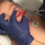 Ankara'da Pitbull Saldırısında İki Çocuk Yaralandı 6 ankarada pitbull saldirisina ugrayan 15 ve 5 yasindaki kardesler yaralandi a0e75eef31c8