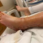 eski esinin otomobille carpip agir yaraladigi hatice olmek istemiyorum video eklendi 2e9add866464