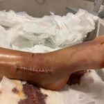 eski esinin otomobille carpip agir yaraladigi hatice olmek istemiyorum video eklendi 2ee187801424