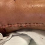 eski esinin otomobille carpip agir yaraladigi hatice olmek istemiyorum video eklendi fa5a1bf0317a