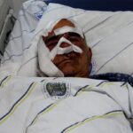 hayvan otlatirken ayi saldirdi yuzunden yaralandi 2fc3d596b5e6