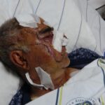 hayvan otlatirken ayi saldirdi yuzunden yaralandi 338b3765ed11