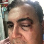 Bakırköy'de Kedileri Besleyen İş İnsanı Saldırıya Uğradı, Şikayetçi Oldu! 6 istanbul bakirkoyde sokakta kedi besleyen is insanini yolu kapattigini one surerek darbetti d7aee6f4b120