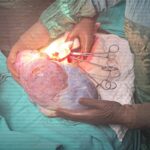 orduda hastanin karnindan 5 kiloluk kitle cikarildi 4771e17bd9fc