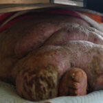 5 yildir evden cikamayan 300 kiloya ulasan fil hastasinin hayali esiyle kol kola caddede gezmek d5f2a7282f1c