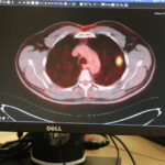 akciger kanserini yenen 50 yillik sigara tiryakisi 2 aydir adini anmiyorum 1d2c73fd2133