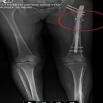 Cinsel saldırı ve cinayetten müebbet hapis cezası aldı; 70 yıl daha eklenerek cezası artırıldı 6 arkadasini oldurup yaraladigi sevgilisini 21 gun boyunca evinde tutan saniga muebbet ile 70 yil hapis c8e4a31ae77d