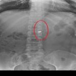 Cinsel saldırı ve cinayetten müebbet hapis cezası aldı; 70 yıl daha eklenerek cezası artırıldı 7 arkadasini oldurup yaraladigi sevgilisini 21 gun boyunca evinde tutan saniga muebbet ile 70 yil hapis d142dd3ec236