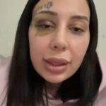 istanbul kagithanede esini silah cekip darbeden bilal burun estetigi yaptirip benden bosanmak istedi 572b3ef8f1bb