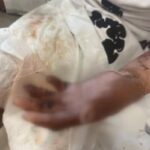 Kağıthane'de Kuaförde Yangın, Genç Çocuk Ağır Yaralandı ve Yeniden Hayata Döndü 14 istanbul kagithanede kuafordeki yanginda vucudu yanan 15 yasindaki engin mucadeleyi kesinlikle birakmasinlar ben yilmadim 33be2461deae