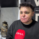 Kağıthane'de Kuaförde Yangın, Genç Çocuk Ağır Yaralandı ve Yeniden Hayata Döndü 2 istanbul kagithanede kuafordeki yanginda vucudu yanan 15 yasindaki engin mucadeleyi kesinlikle birakmasinlar ben yilmadim 3c2575bdc9d4