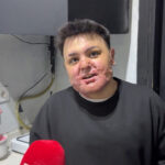 Kağıthane'de Kuaförde Yangın, Genç Çocuk Ağır Yaralandı ve Yeniden Hayata Döndü 1 istanbul kagithanede kuafordeki yanginda vucudu yanan 15 yasindaki engin mucadeleyi kesinlikle birakmasinlar ben yilmadim a00a6bdac950