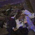 Kağıthane'de Kuaförde Yangın, Genç Çocuk Ağır Yaralandı ve Yeniden Hayata Döndü 9 istanbul kagithanede kuafordeki yanginda vucudu yanan 15 yasindaki engin mucadeleyi kesinlikle birakmasinlar ben yilmadim cb5886f5688f