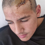 Konya'da öğrencinin başına taş atarak yaralayan arkadaşının serbest kalmasına ailesinden tepki! 5 sakalastigi okul arkadasi tasla hasan berati hastanelik etti dd6c3d2f1f6f