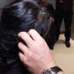 istanbul 55 aylik hamile nazirenin beyninden 7 santimetrelik tumor cikarildi 6b62703ee248