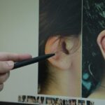 kepce kulak ameliyati ozguveni artiriyor f7f571a1e211