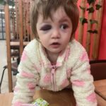 Baba ile 14 aylık bebeğinin darbedildiği olayda şüphelilerin ifadesi ortaya çıktı 4 baba ile 14 aylik bebeginin darbedildigi olayda suphelilerin ifadesi ortaya cikti 0fc9e393d52f