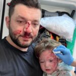 cocuk annesinin kucagindan dustu babasi kendi burnundaki kani uzerine akitti c38a0f00a8f5