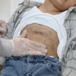 tesadufen fark edilen nadir hastalik ameliyatla tedavi edildi eedc6dbe6877