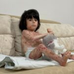 4 yaşındaki İbrahim, 'Kelebek hastalığı' nedeniyle kıyafet giyemiyor 2 4 yasindaki ibrahim kelebek hastaligi nedeniyle kiyafet giyemiyor b8ffe1cae10b