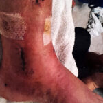 arkeolojik kazi alanindaki cukura dusunce ayaginda yuzde 3luk engel olustu 1 milyon lira tazminat karari cikti fe47720afabd